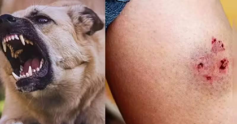 ഏഴ് മാസം മുന്‍പ് നായയുടെ കടിയേറ്റയാള്‍ പേവിഷബാധാ ലക്ഷണങ്ങളോടെ മരിച്ചു; പ്രതിരോധ കുത്തിവെപ്പ് ഒരു ഡോസ് എടുത്തെന്ന് ബന്ധുക്കള്‍ 